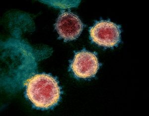 Novel_Coronavirus_SARS-CoV-2-scaled-e1598282299955 - TA NEA - TA NEA