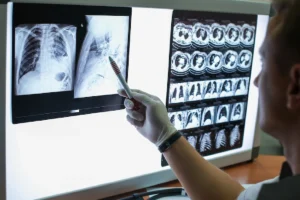 LUNGS - TA NEA - TA NEA